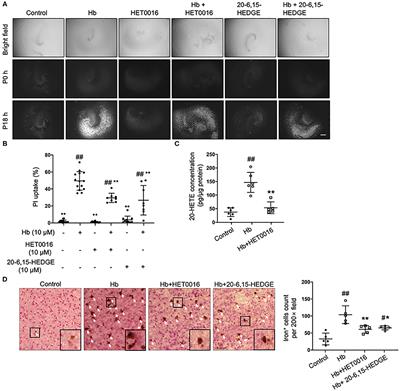 20-HETE Participates in Intracerebral Hemorrhage-Induced Acute Injury by Promoting Cell Ferroptosis